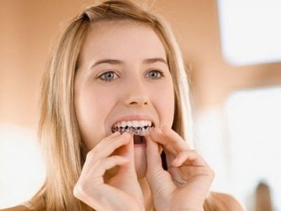 Anvisa proíbe venda de clareador dental sem prescrição