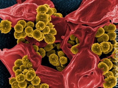 Antibiótico revolucionário impede que bactérias desenvolvam resistência 