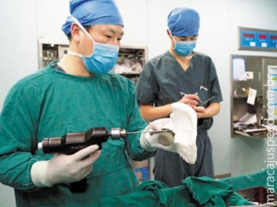 Médicos chineses implantam com sucesso osso fabricado com impressora 3D