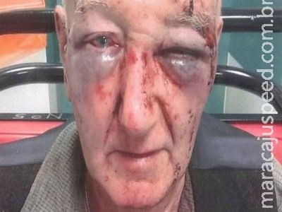 Idoso britânico é espancado após pedir que homem não urinasse na rua