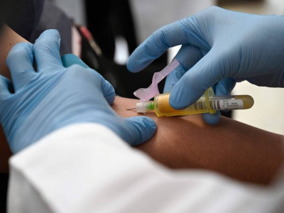 Vacina contra HIV entrará em fase avançada de teste em humanos em oito países, inclusive o Brasil