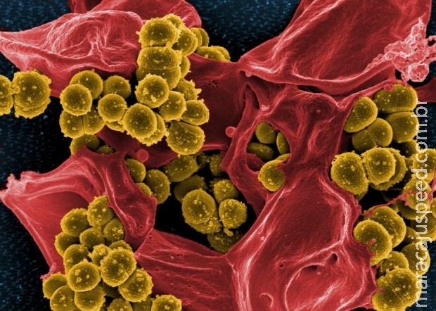 Antibiótico revolucionário impede que bactérias desenvolvam resistência 