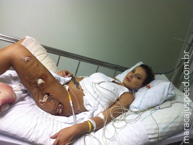 IMAGENS FORTES: Agência divulga fotos de Andressa Urach no hospital