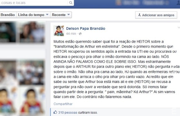 Pai diz que siamês sobrevivente ainda não perguntou do irmão que morreu