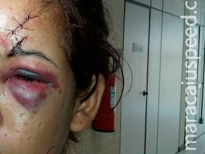 Mulher é espancada em festa e diz que ataque ocorreu após "esbarrão"