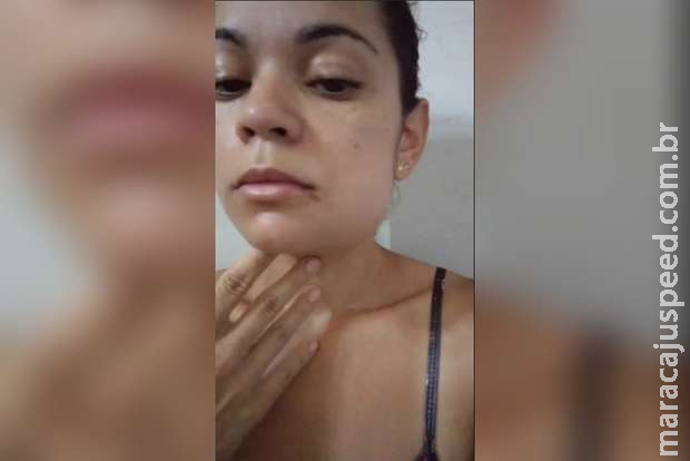 Paciente retira siso e quase morre de dor sem assistência de clínica em Campo Grande