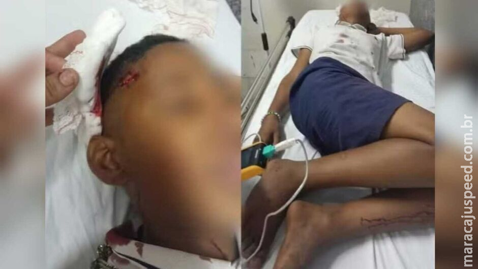 Criança tem crânio rachado após ser agredido com paulada em escola de MT